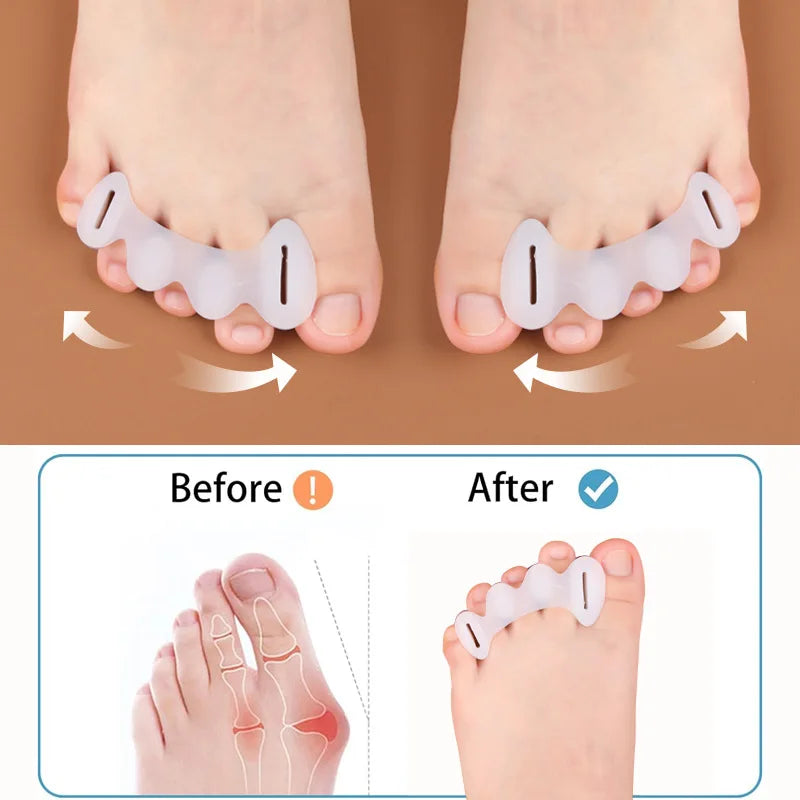 Separadores Ortopédicos de Dedos em Silicone para Correção de Joanetes